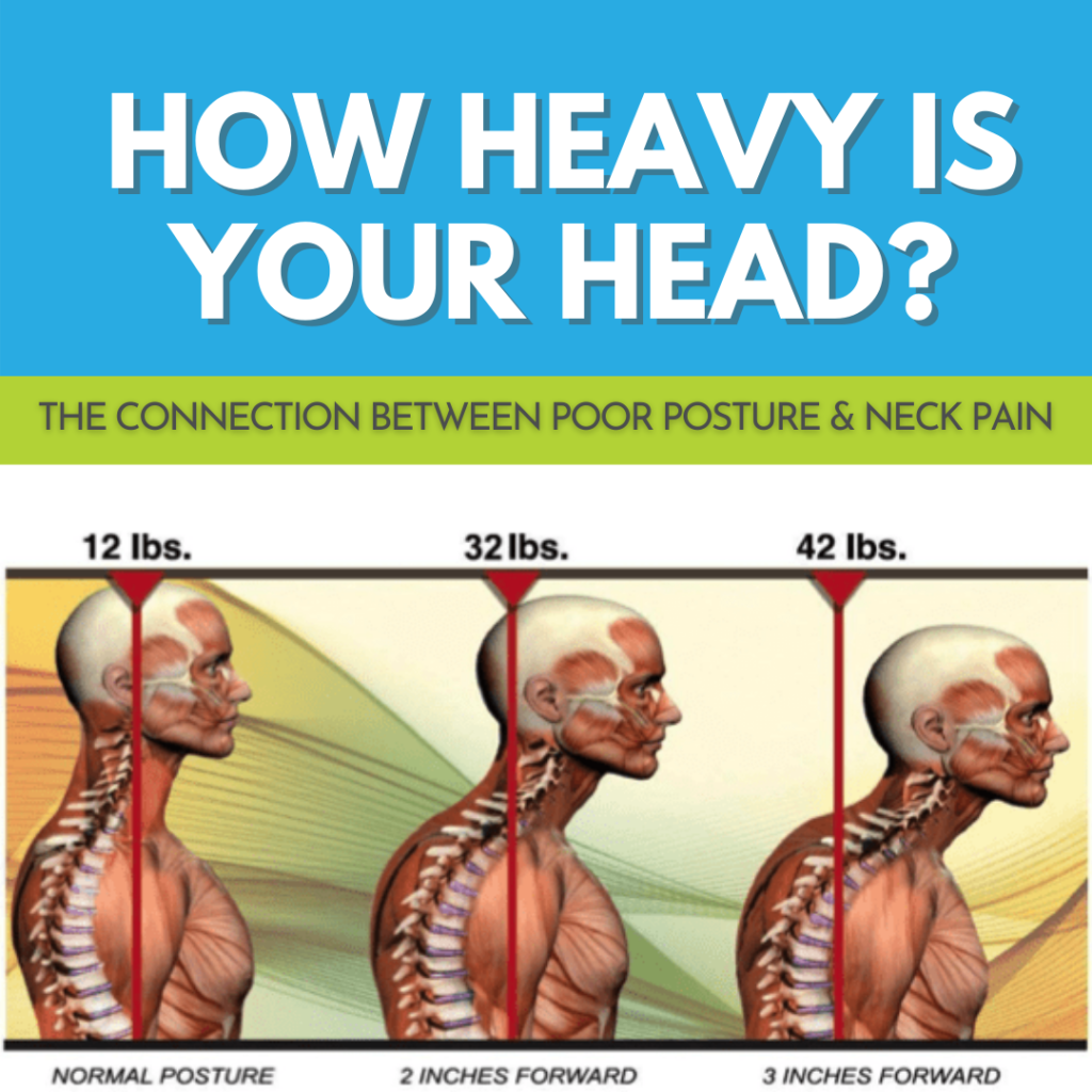 forward head posture neck hump